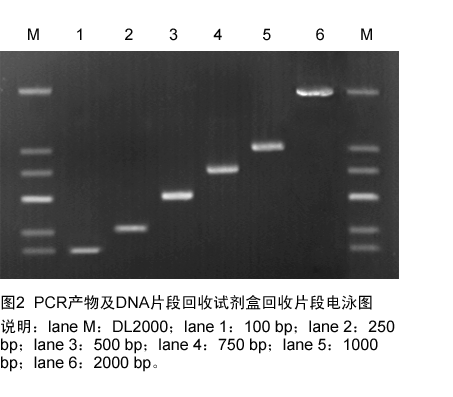 图2  pcr产物纯化电泳图